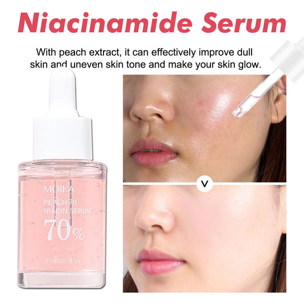 Niacinamide Serum – Dark Spot Remover & Skin Perfecter