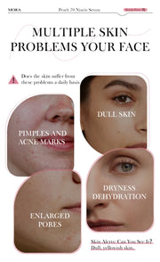 Niacinamide Serum – Dark Spot Remover & Skin Perfecter