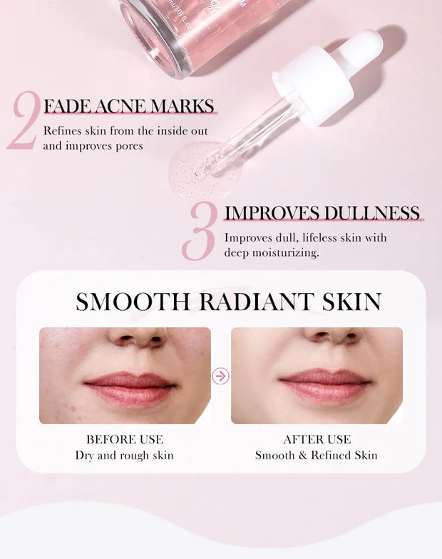 Niacinamide Serum – Dark Spot Remover & Skin Perfecter